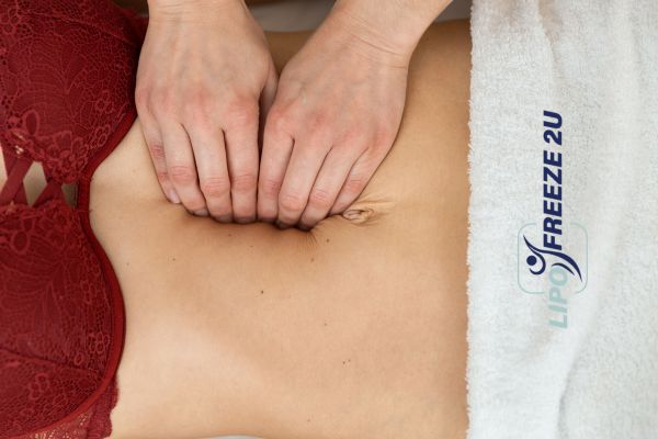 diastasis recti treatment Stirling
