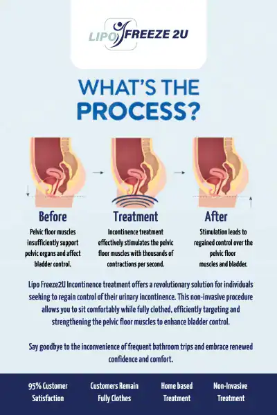 Diagram of how incontinence treatment Stirling works.