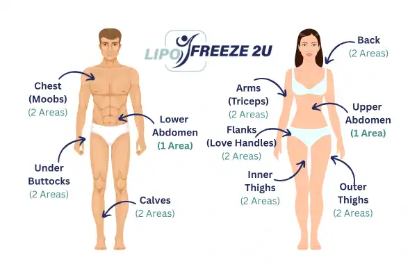 Areas you can have fat freezing treatment Stirling