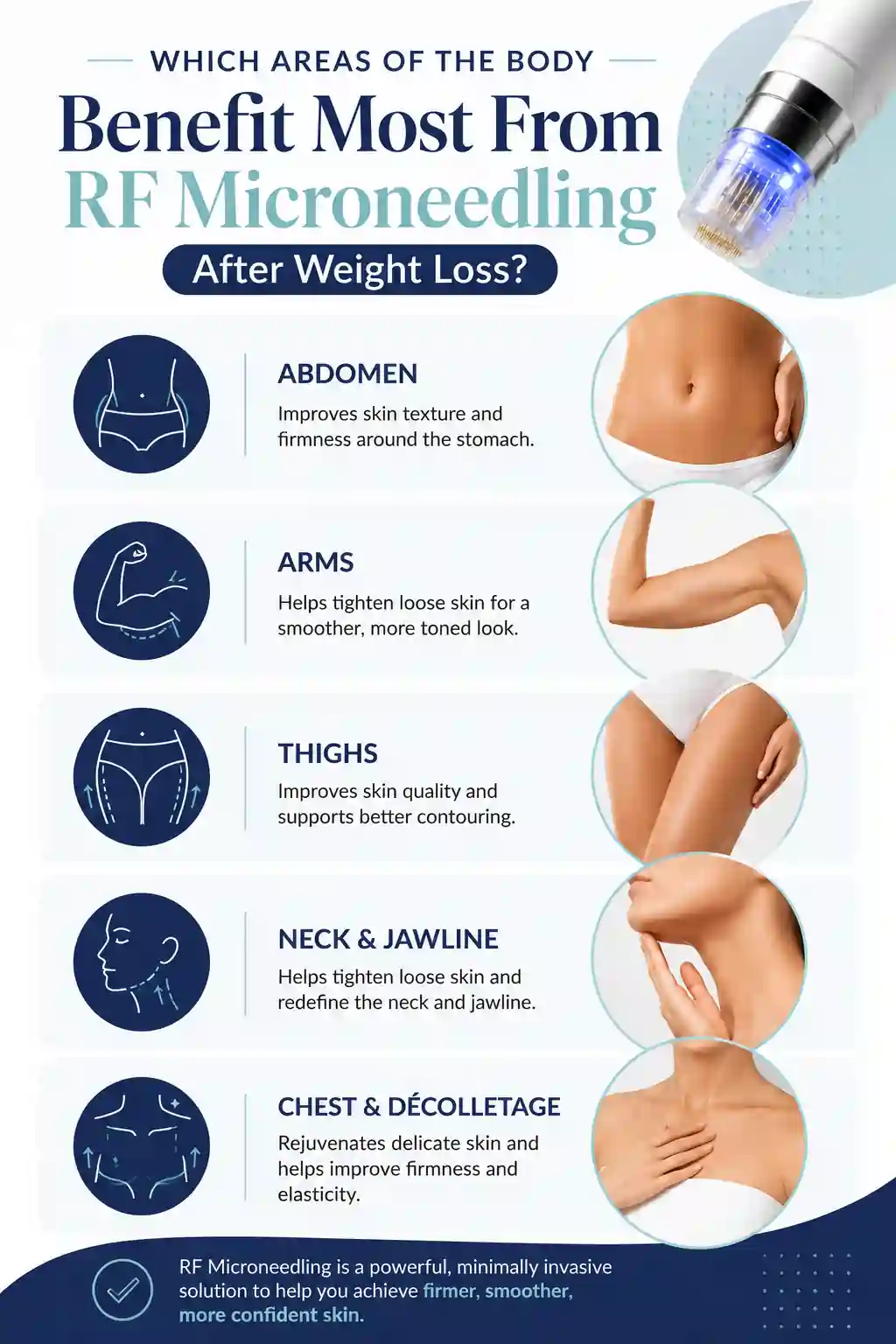 Which Areas of the Body Benefit Most From RF Microneedling After Weight Loss Stirling